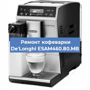 Ремонт помпы (насоса) на кофемашине De'Longhi ESAM460.80.MB в Нижнем Новгороде
